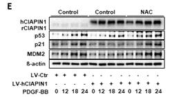 동맥경 화 유발한 Balloon injury rat의 혈관에 서 CIAPIN1, p53, MDM2 및 miRNA 의 발현 수준 관찰