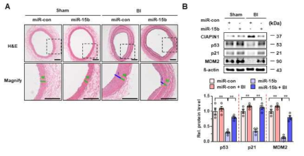 획득한 혈관에서 CIAPIN1, p53, MDM2 및 miRNA의 발현 수준 관찰