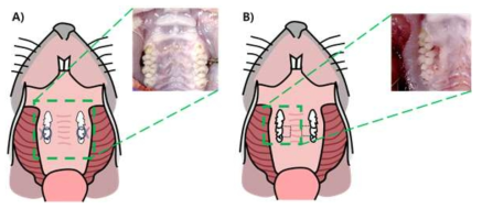 Schematic diagram and photos of ligature induced periodontitis model, A) Location of ligature, B) Location of gingival tissue collection for qPCR