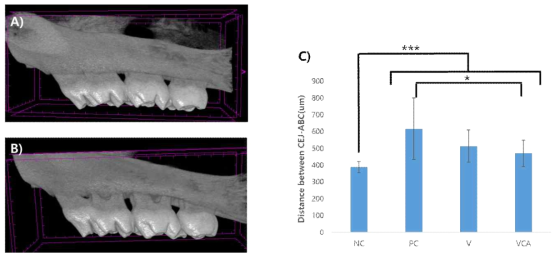 Alveolar bone loss in rat was measured by micro-computed tomography. A)Negative control B)Positive control C) Distance between Cemento-enamel junction (CEJ) and alveolar bone crest (ABC), data are expressed as mean ± SD, ***P<0.001, *P<0.05 NC: Negative control, PC: positive control, V: Varnish, VCA Varnish with CA