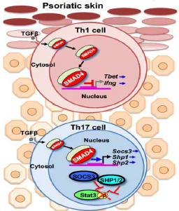 건선에서 SMAD4- TGF-β의 Th1, Th17 분화 억제조절기전