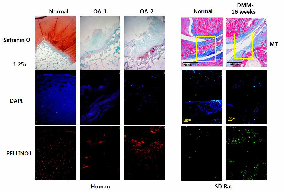 정상 및 관절염 조직에서 Pellino-1의 발현양상