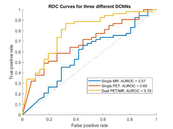 Receiver operating characteristic (ROC) curves of testing dataset for different DCNNs