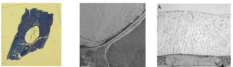 급속 냉동 고정한 후 제브라피쉬 투과 전자현미경 좌: Semi-thin section, 중: 혈관내막 위의 물결무늬 구조물은 ice crystal 이 생기면서 손상을 주어 생긴 혈장단백질로 생각하였음. 우: Ebong et al. 의 2011 연구에서 eGC 라고 주장한 혈관표면 구조와 유사함