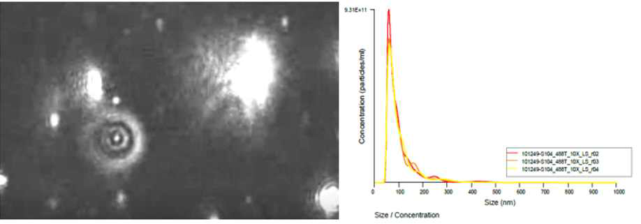 혈중에서 추출한 엑소좀 (좌 Transmission electron microscopy, 우 nanoparticle tracking analysis)