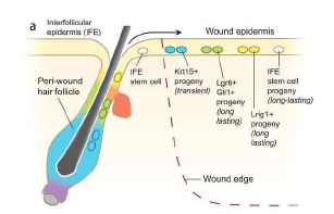 창상유도모낭재생에서 모낭간표피세표의 역할