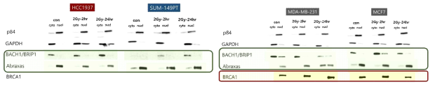 Irradiation 후 cytosol과 nuclear fractionation 검체에서 BRCA1 및 binding partner들의 발현 상태