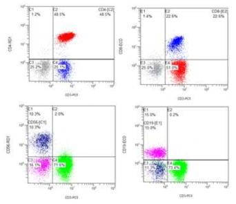 유세포검사법을 사용한 림프구 아형검사에서 T 림프구, B림프구, NK 림프구 검출 예시