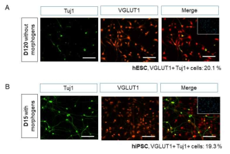 hiPSC유래 글루타민성 신경세포의 분화를 증진시키는 분화조건 확립