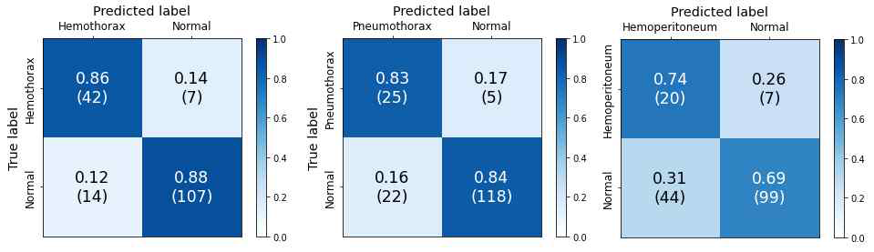 외부 데이터 2의 per-patient confusion matrix