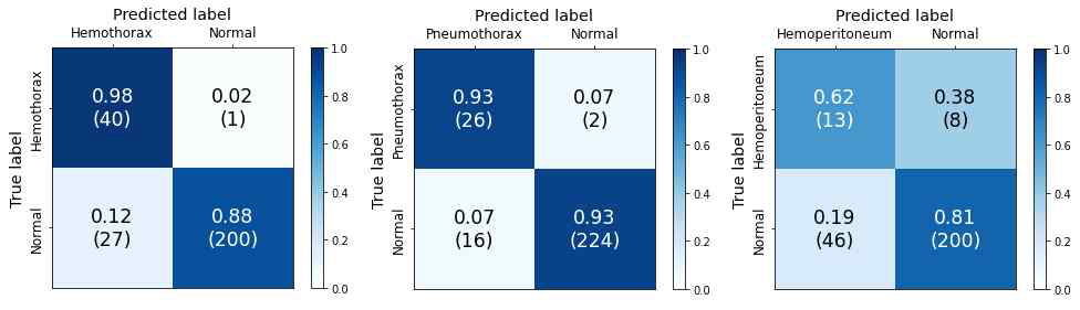 외부 데이터 1의 per-patient confusion matrix