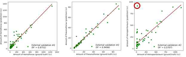 각 병변의 volume과 AI 모델이 예측한 volume의 correlation (외부데이터 2)