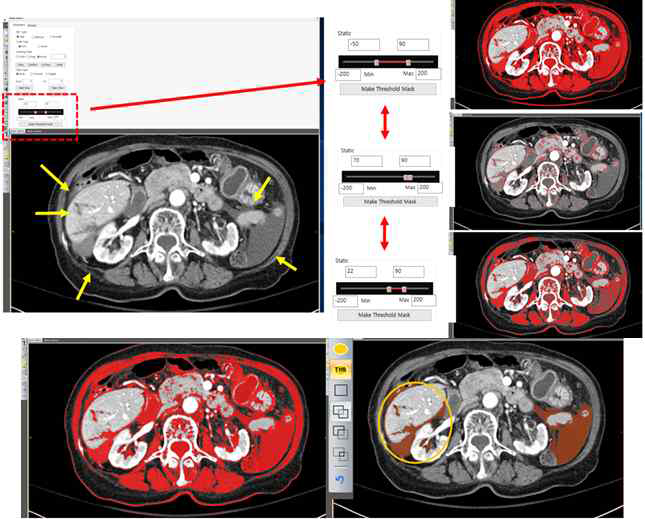 CT HU의 상한/하한 조정을 통한 효율적 레이블링 가능한 전신 외상 CT 전용 레이블링 SW