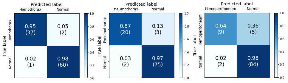 Per-patient confusion matrix