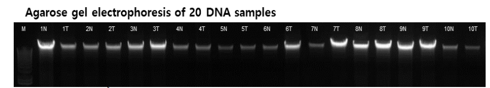 Agarose gel electrophoresis of 20 DNA samples