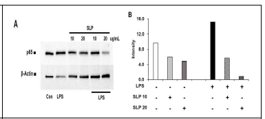 유산균 s-layer protein 처리 후 Raw264.7세포의 NF-κB 단백질 발현량