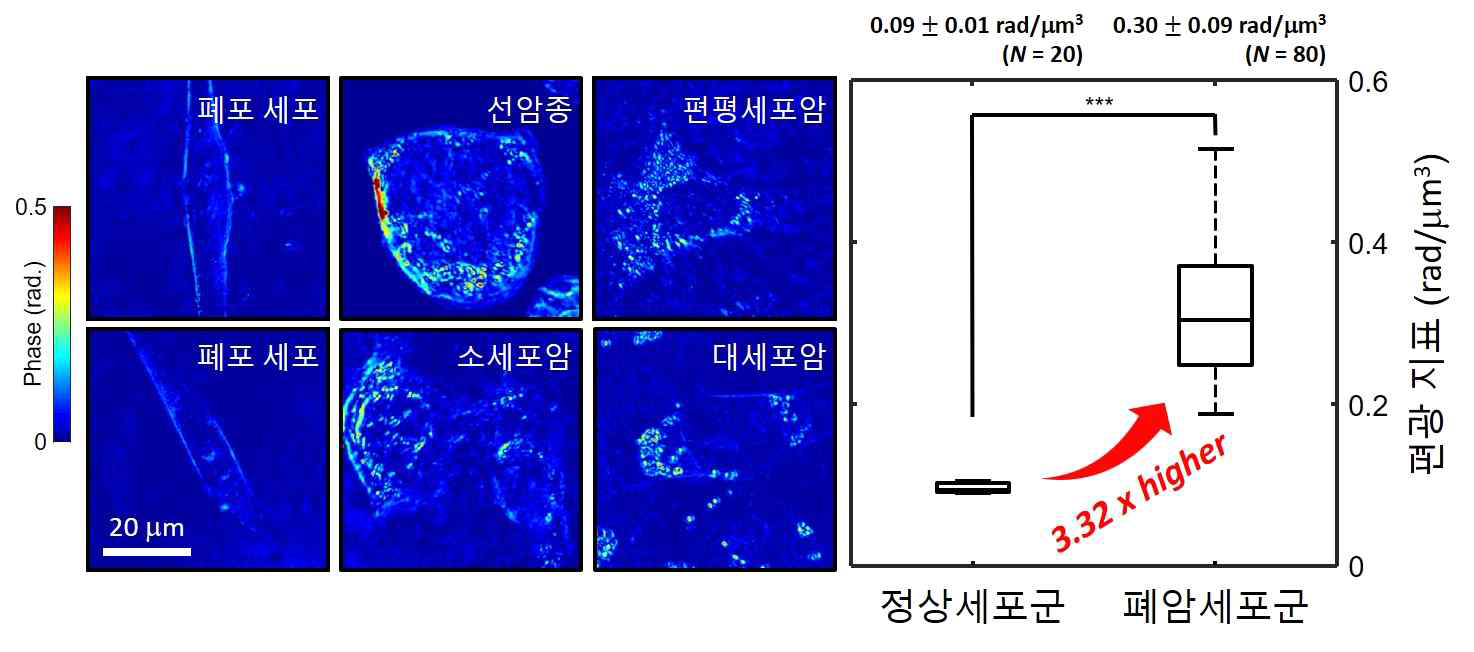 정상 세포와 폐암 세포의 위상 지연 영상 (왼쪽), 정상 세포군과 폐암 세포군의 편광지표 비교