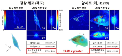 정상 세포와 암세포의 면적, 부피 및 편광 특이물질의 분포 비교