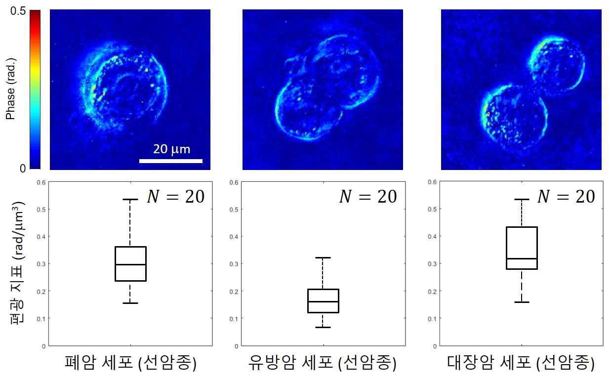 서로 다른 암세포군 (폐, 유방, 대장)의 위상 지연 영상 및 편광지표 분포 비교