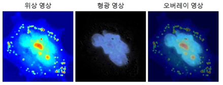 폐암 세포 (대세포암종, H1299)의 위상 영상, 형광 영상 및 오버레이 영상