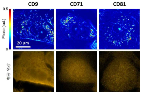 표면 단백질 CD9, CD71, CD81을 표지하기 위해 형광 처리된 폐암 세포 (선암 종, H1650)의 위상 지연 영상 (위쪽), 형광 영상 (아래쪽)