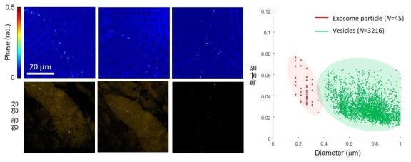 3종의 폐암 세포 이형 타입 (왼쪽부터 선암 종, 대세포암, 편평세포암종)에 대한 엑소좀 추출물의 위상 지연 영상 및 형광 영상. 엑소좀과 소포의 크기에 따른 편광 반응 비교