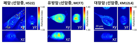 서로 다른 암세포 (폐암, 유방암, 대장암)의 3차원 단층 영상