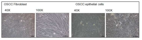 환자 유래 조직을 이용한 primary cell culture – OSCC fibroblast & OSCC epithelial cell