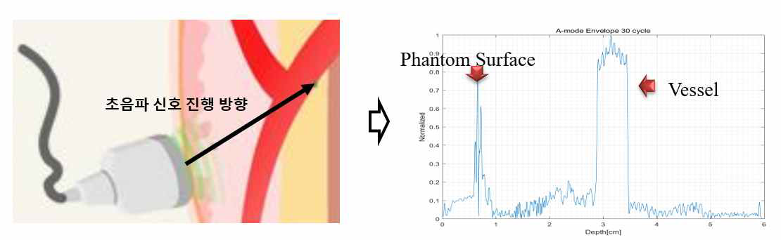 도플러 시스템을 이용한 혈관 벽의 위치 판별과 Flow 데이터 획득
