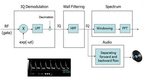 도플러 시스템의 Signal processing 알고리즘