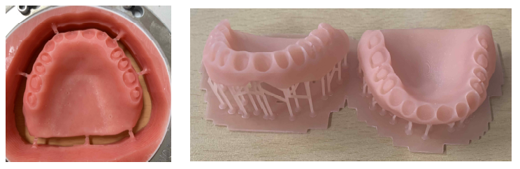 절삭가공과 3D 프린팅으로 제작한 의치상