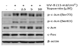 c-Jun, c-Fos 단백질의 변화