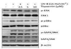 MAPK 신호전달에 관련된 단백질 발현 분석