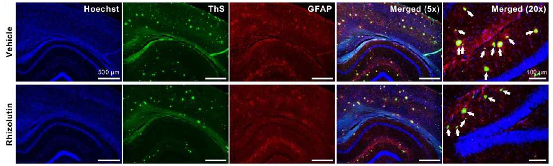 Rhizolutin 투여는 hippocampus에서 Aβ 플레이크를 감소시키고 (ThS 염색), 플레이크 주변의 astrocytosis를 감소시킴