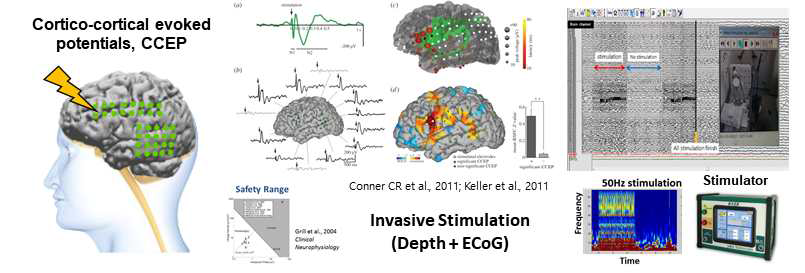 피질유발전위 (CCEP) 및 침습적 뇌전기자극의 예