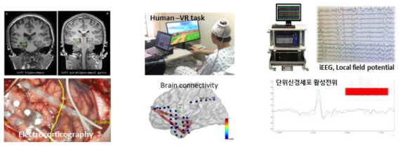 (사람) 삽입된 전극위치확인(좌), 작업기억 과제 수행(중), 중 뇌활동성 측정 및 뉴랄링스 시스템(우)