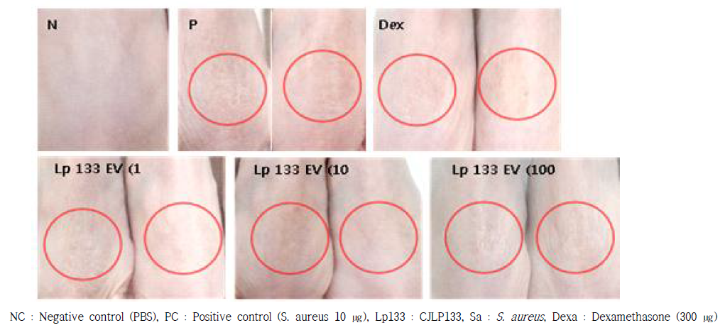 황색포도상구균 (S. aureus) 유래소포에 의한 아토피피부염 마우스모델에서 유산균 유래소포 피부투여 시 육안적인 변화