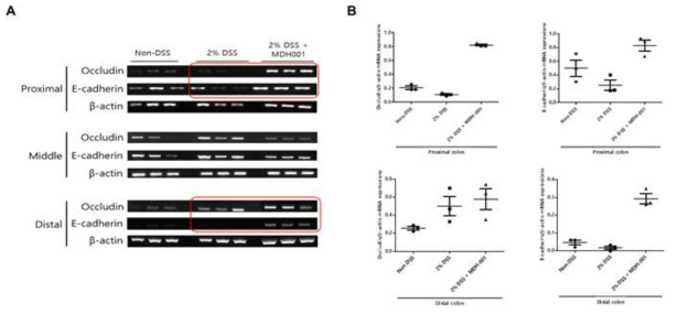 DSS 유도 급성 대장염 모델의 대장 조직에서의 MDH-001 투여에 따른 tight junction 마커 변화 확인