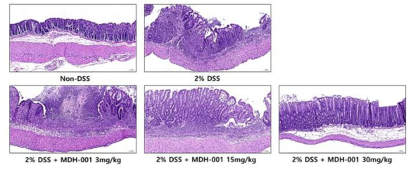 DSS 유도 급성 대장염 모델에서의 MDH-001 투여 용량별 장 조직의 변화 확인