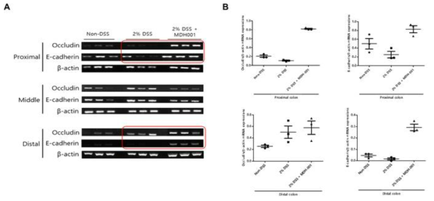 DSS 유도 급성 대장염 모델의 대장 조직에서의 MDH-001 투여에 따른 tight junction 마커 변화