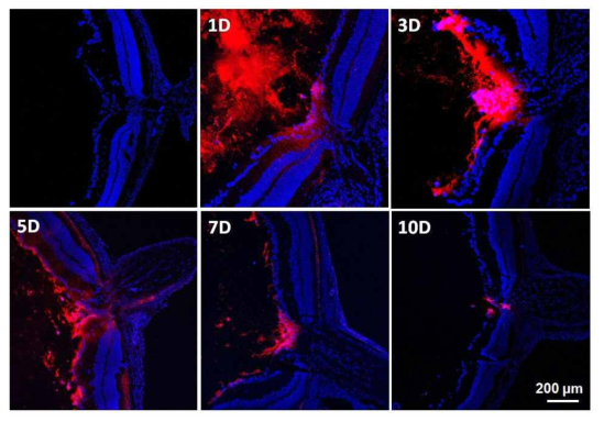 Images with lower magnification of the central retina including optic nerve head