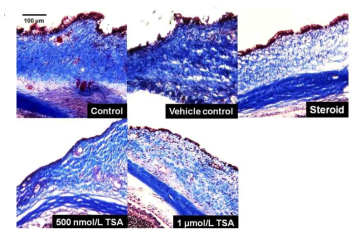 Masson’s trichrome staining of the bleb tissues. The bleb tissues were collected at day 14 after trabeculectomy. Prominent collagen deposition was observed in the control group, whereas decreased collagen deposition with loosely arranged fibers was observed in the topical steroid- and 1 lmol/L TSA-treated eyes