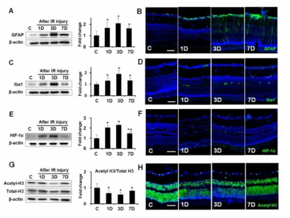 Expression of GFAP, Iba1, HIF-1a, and acetyl-H3 in ischemic retinas according to time interval. Representative cropped western blots depicting GFAP, Iba1, HIF-1, acetyl-H3, and total-H3 protein levels, respectively