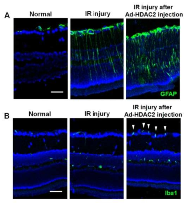 The effect of HDAC2 overexpression on glial cell activities. IR injury markedly upregulated the expression of macroglial (GFAP; A) and microglial (Iba1; B) expression at day 3. The increased expression of Iba1 was remarkable at the ganglion cell layer and nerve fiber layer (white arrowheads). Overexpression of HDAC2 significantly exacerbates glial cell expressions in mouse retinas after IR injury. Scale bars, 50 m