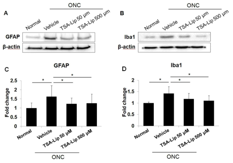 Effect of intravitreally injected TSA-loaded liposomes on gliosis in retina after optic nerve crush (ONC)