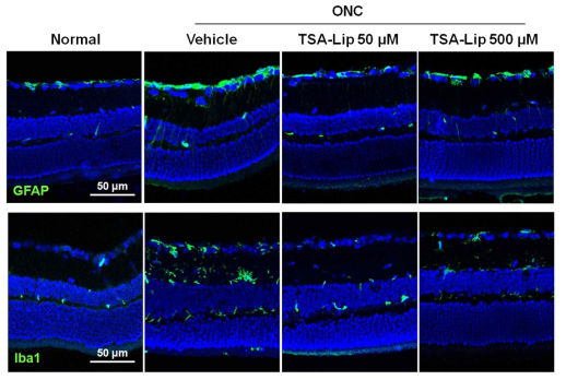 Immunohistochemical staining of GFAP and Iba1 in retinas after ONC (Upper) Sections from vehicle-injected retinas after ONC show increased GFAP activity on the RGC layer and the radial process of macroglial cells spanning the inner plexiform layer. The intravitreal injection of TSA-loaded liposomes significantly attenuated the GFAP activity in retinas after ONC. (Lower) Immunolabeling for Iba1 in retinal sections showed prominent activation of microglia in vehicle-injected retinas after ONC. This activation was ameliorated in the retinas injected with TSA-loaded liposomes