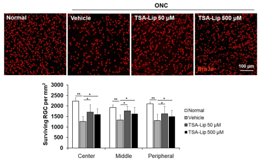 TUNEL staining was performed on retinal sections 7 days after ONC. Effect of TSA-loaded liposomes on RGC survival after ONC. Retinal flat mounts are shown for the uninjured normal retinas, vehicle-injected retinas, and retinas injected with 50 μM and 500 μM TSA-loaded liposomes (n = 5 retinas per group). A quantitative analysis of RGC survival in center, middle, and peripheral zones of each retinal quadrant is also shown as a graph. Scale bar = 100 m; ** p < 0.001, compared to the uninjured normal retina; * p < 0.05 compared to the vehicle-injected retina