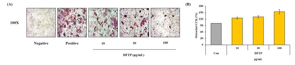 Effects of DFTP on TRAP staining (A) and cell viability (B) in RANKL-stimulated bone marrow derived-macrophages. Data are presented as ± S.E