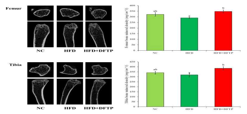 Effects of micro CT images and bone mineral density in high-fat diet induced obese mice. Data are presented as ± S.E. abMeans not sharing a common letter are signifiacntly different among groups (P<0.05)