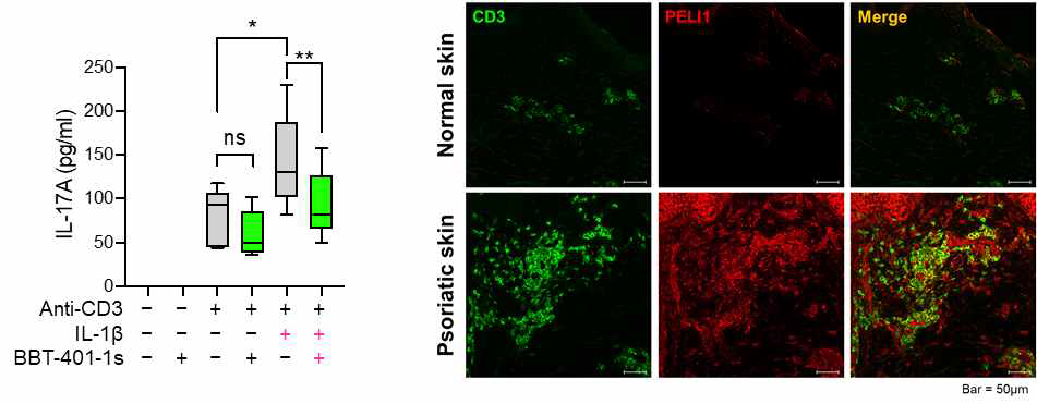 Peli1 억제제에 의한 CD4+ T 세포 IL-17A 생성 억제와 건선병변에서 증가한 PELI1 발현 T 세포